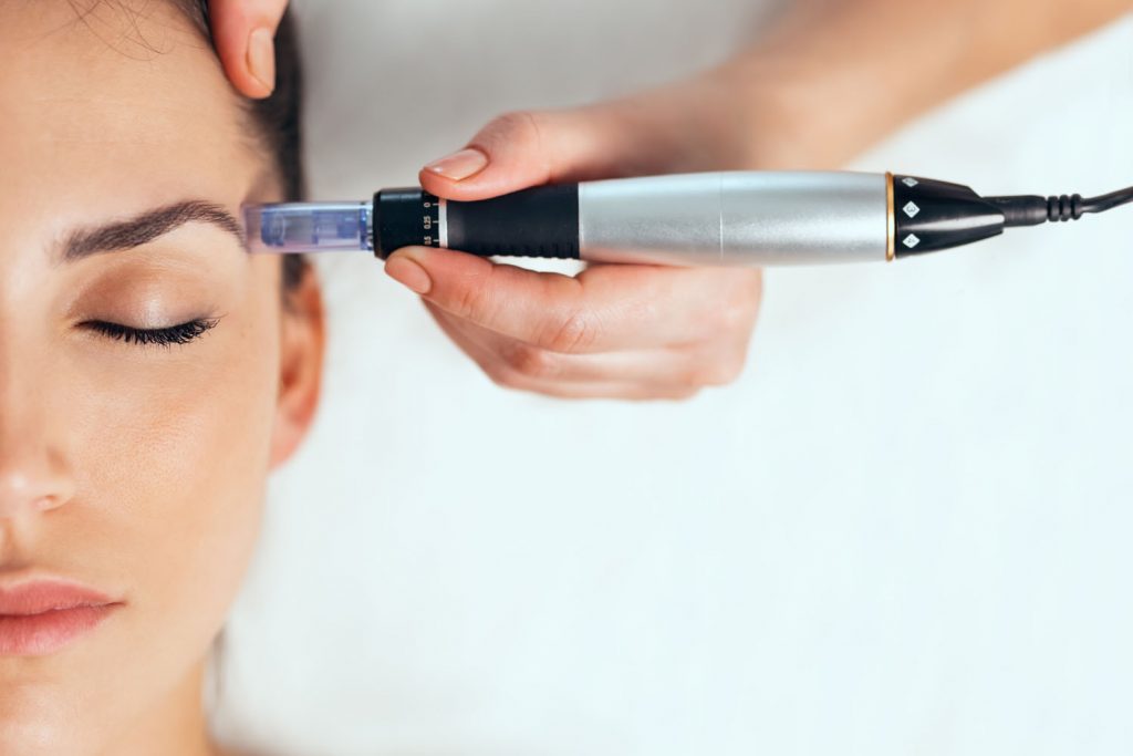 dermapen valencia