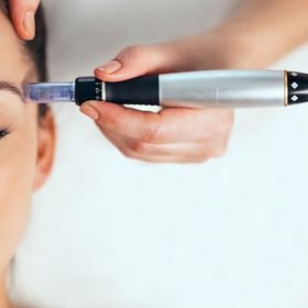 dermapen valencia